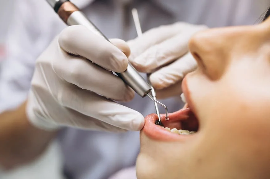Làm Thế Nào Để Chăm Sóc Răng Miệng Đúng Cách Ngay Tại Nhà?